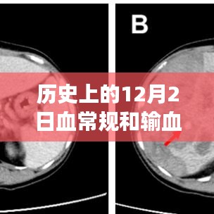 历史上的12月2日，血常规与输血技术的重大进展与回顾