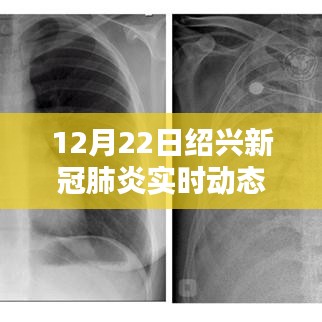 绍兴新冠肺炎实时动态报告（12月22日更新），聚焦最新动态分析