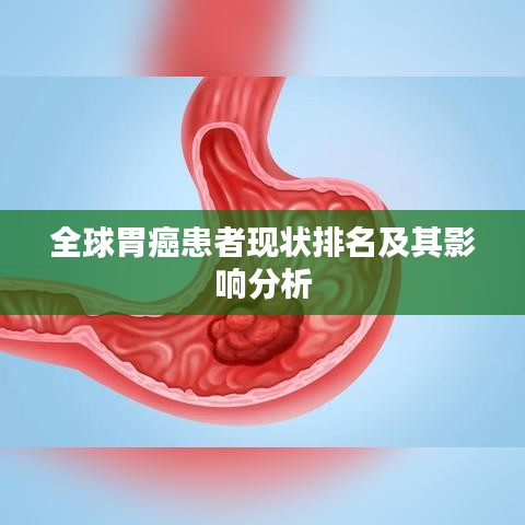 全球胃癌患者现状排名及其影响分析