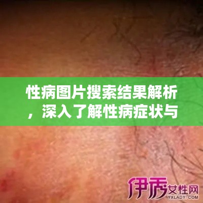 性病图片搜索结果解析，深入了解性病症状与防治知识
